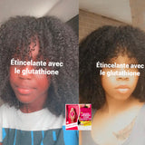 Gluta Primme BARBIE X6